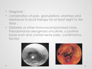 • Diagnosis :
• combination of pain, granulations, otorrhea and
resistance to local therapy for at least eight to ten
days .
• Diabetes or other immunocompromised state,
Pseudomonas aeruginosa onculture, a positive
bone scan and cranial nerve palsy -confirmatory
factors
 