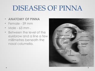 DISEASES OF PINNA
• A
• ANATOMY OF PINNA
• Female - 59 mm
• Male - 63 mm .
• Between the level of the
eyebrow and a line a few
millimetres beneath the
nasal columella.
 