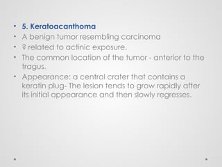 • 5. Keratoacanthoma
• A benign tumor resembling carcinoma
• ? related to actinic exposure.
• The common location of the tumor - anterior to the
tragus.
• Appearance: a central crater that contains a
keratin plug- The lesion tends to grow rapidly after
its initial appearance and then slowly regresses.
 