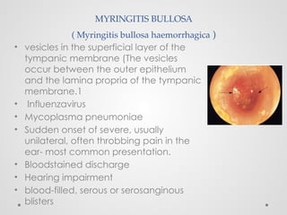 MYRINGITIS BULLOSA
( Myringitis bullosa haemorrhagica )
• vesicles in the superficial layer of the
tympanic membrane (The vesicles
occur between the outer epithelium
and the lamina propria of the tympanic
membrane.1
• Influenzavirus
• Mycoplasma pneumoniae
• Sudden onset of severe, usually
unilateral, often throbbing pain in the
ear- most common presentation.
• Bloodstained discharge
• Hearing impairment
• blood-filled, serous or serosanginous
blisters
 