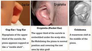Comprehensive Overview of External Ear Disorders and Management | PPTX