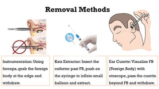 Comprehensive Overview of External Ear Disorders and Management | PPTX