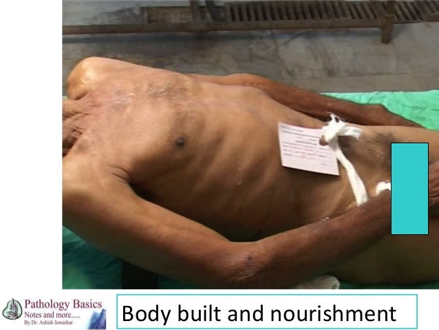 external examination at autopsy