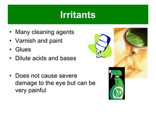 Irritants
•
•
•
•

Many cleaning agents
Varnish and paint
Glues
Dilute acids and bases

• Does not cause severe
damage to the eye but can be
very painful

 