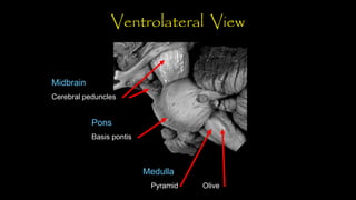 Pyramids Pons External features of brain stem (Anatomy).pdf