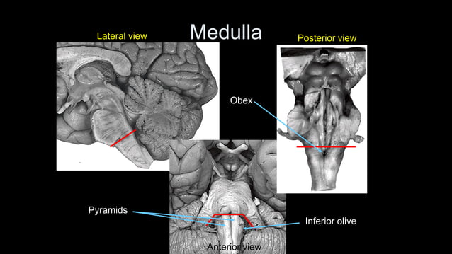 External features of brain stem (Anatomy).pdf