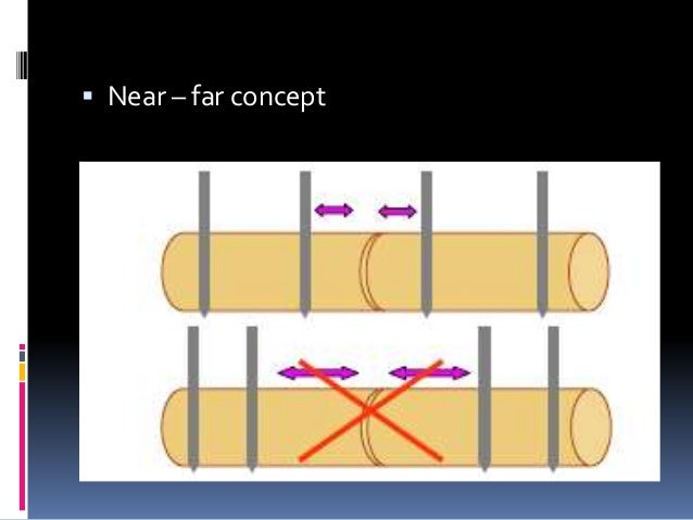 Principles Of External Fixation