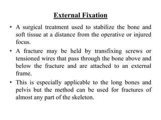 External Fixation.pptx