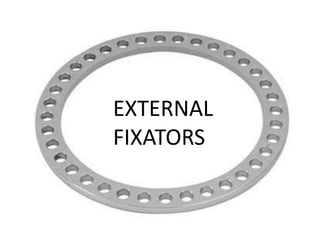 EXTERNAL
FIXATORS
 