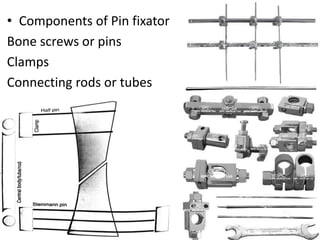 • Components of Pin fixator
Bone screws or pins
Clamps
Connecting rods or tubes
 