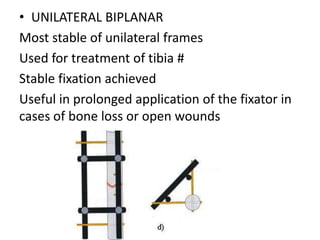 • UNILATERAL BIPLANAR
Most stable of unilateral frames
Used for treatment of tibia #
Stable fixation achieved
Useful in prolonged application of the fixator in
cases of bone loss or open wounds
 