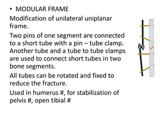 • MODULAR FRAME
Modification of unilateral uniplanar
frame.
Two pins of one segment are connected
to a short tube with a pin – tube clamp.
Another tube and a tube to tube clamps
are used to connect short tubes in two
bone segments.
All tubes can be rotated and fixed to
reduce the fracture.
Used in humerus #, for stabilization of
pelvis #, open tibial #
 