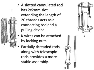• A slotted cannulated rod
has 2x2mm slot
extending the length of
20 threads acts as a
connecting rod and a
pulling device
• K wires can be attached
by locking nuts
• Partially threaded rods
along with telescopic
rods provides a more
stable assembly.
 