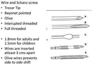 Wire and Schanz screw
• Trocar Tip
• Bayonet pointed
• Olive
• Interupted threaded
• Full threaded
• 1.8mm for adults and
1.5mm for children
• Wires are inserted
atleast 3 cms apart
• Olive wires prevents
side to side shift
 