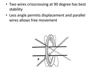 • Two wires crisscrossing at 90 degree has best
stability
• Less angle permits displacement and parallel
wires allows free movement
 