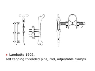  Lambotte 1902,
self tapping threaded pins, rod, adjustable clamps
 