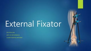 External Fixator
DR DITESH JAIN
DEPT. OF ORTHOPAEDICS
LILAVATI HOSPITAL MMUMBAI
 