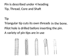 Pin is described under 4 heading
Tip, Thread, Core and Shaft
Tip
Triangular tip cuts its own threads in the bone.
Pilot hole is drilled before inserting the pin.
A variety of pin tips are in use
 