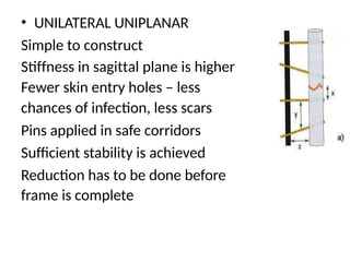 • UNILATERAL UNIPLANAR
Simple to construct
Stiffness in sagittal plane is higher
Fewer skin entry holes – less
chances of infection, less scars
Pins applied in safe corridors
Sufficient stability is achieved
Reduction has to be done before
frame is complete
 
