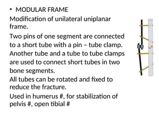 • MODULAR FRAME
Modification of unilateral uniplanar
frame.
Two pins of one segment are connected
to a short tube with a pin – tube clamp.
Another tube and a tube to tube clamps
are used to connect short tubes in two
bone segments.
All tubes can be rotated and fixed to
reduce the fracture.
Used in humerus #, for stabilization of
pelvis #, open tibial #
 