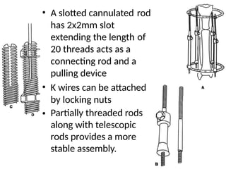 • A slotted cannulated
has 2x2mm slot
extending the length
20 threads acts as a
connecting rod and a
pulling device
rod
of
• K wires can be attached
by locking nuts
Partially threaded rods
along with telescopic
rods provides a more
stable assembly.
•
 