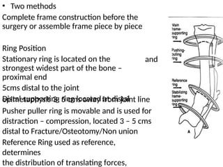 • Two methods
Complete frame construction before the
surgery or assemble frame piece by piece
Ring Position
Stationary ring is located on the
strongest widest part of the bone –
proximal end
5cms distal to the joint
Distal supporting ring located at distal
and
epimetaphysis 3- 5 cms away from joint line
Pusher puller ring is movable and is used for
distraction – compression, located 3 – 5 cms
distal to Fracture/Osteotomy/Non union
Reference Ring used as reference,
determines
the distribution of translating forces,
 