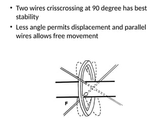 • Two wires crisscrossing at 90 degree has best
stability
Less angle permits displacement and parallel
wires allows free movement
•
 