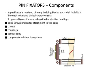 EXTERNAL FIXATORS and its biomechanics ortho | PPTX