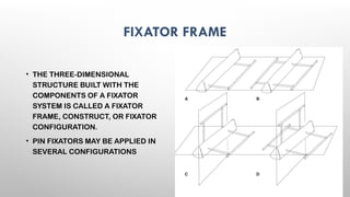 External Fixator Components EXTERNAL FIXATORS principles of exfix .pptx