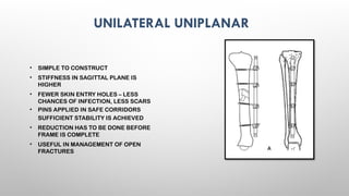 EXTERNAL FIXATORS principles of exfix .pptx