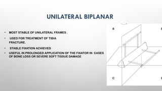 EXTERNAL FIXATORS principles of exfix .pptx