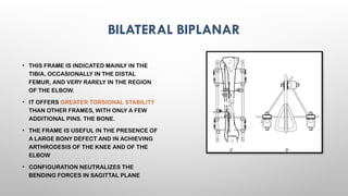 EXTERNAL FIXATORS principles of exfix .pptx