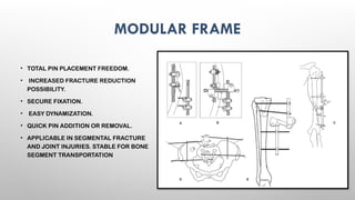 EXTERNAL FIXATORS principles of exfix .pptx