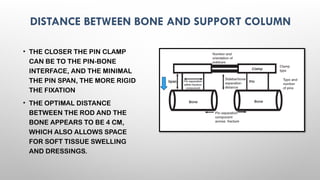 EXTERNAL FIXATORS principles of exfix .pptx