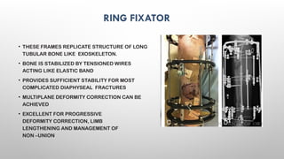 EXTERNAL FIXATORS principles of exfix .pptx