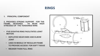 Principles External Fixator EXTERNAL FIXATORS principles of exfix .pptx