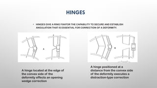 Principles External Fixator EXTERNAL FIXATORS principles of exfix .pptx