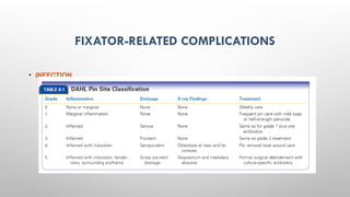 EXTERNAL FIXATORS principles of exfix .pptx