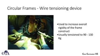 External fixation principles in orthopedic surgery | PDF
