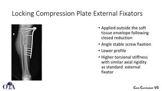 Principles External Fixator External fixation principles in orthopedic surgery | PDF