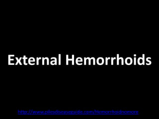 External Hemorrhoids


 http://www.pilesdiseaseguide.com/Hemorrhoidnomore
 