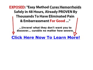 External hemorrhoids treatment