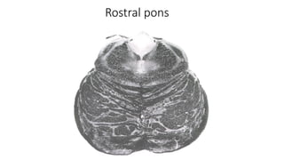 External & Internal features of the pons.pptx