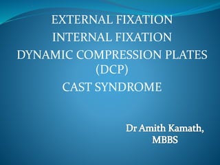 EXTERNAL FIXATION
INTERNAL FIXATION
DYNAMIC COMPRESSION PLATES
(DCP)
CAST SYNDROME
 
