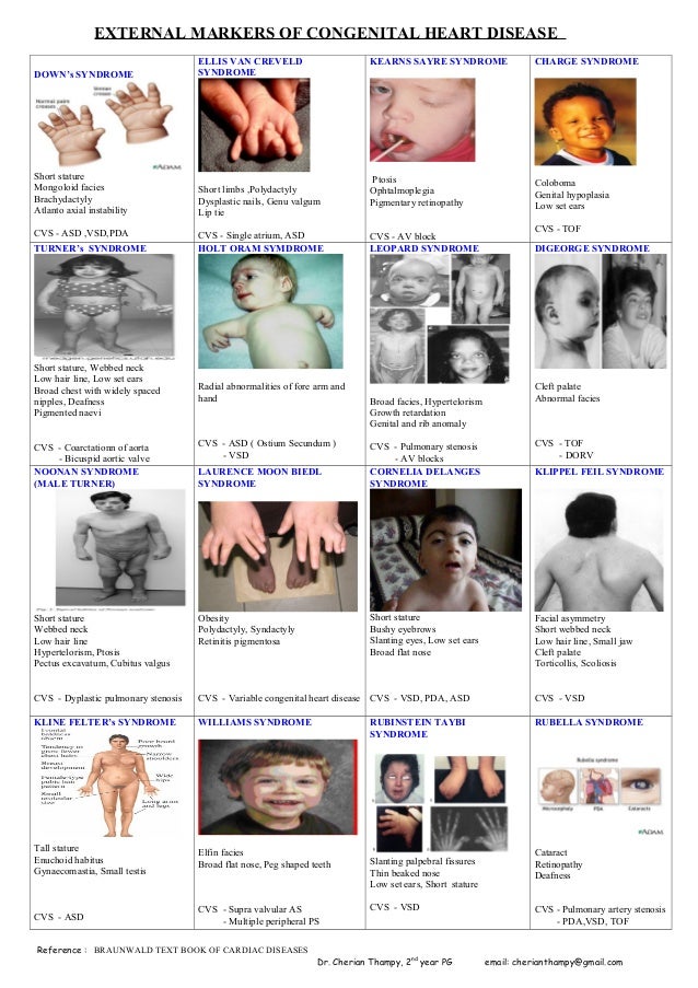 External markers of congenital heart disease