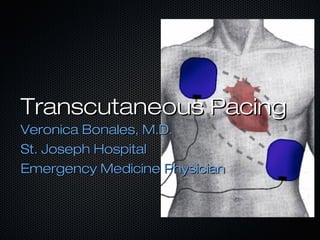 Transcutaneous PacingTranscutaneous Pacing
Veronica Bonales, M.D.Veronica Bonales, M.D.
St. Joseph HospitalSt. Joseph Hospital
Emergency Medicine PhysicianEmergency Medicine Physician
 