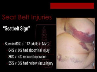 External signs of internal injuries tfinal | PPT