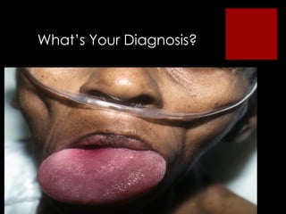What ’s Your Diagnosis? 