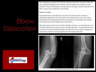Elbow  Dislocation 
