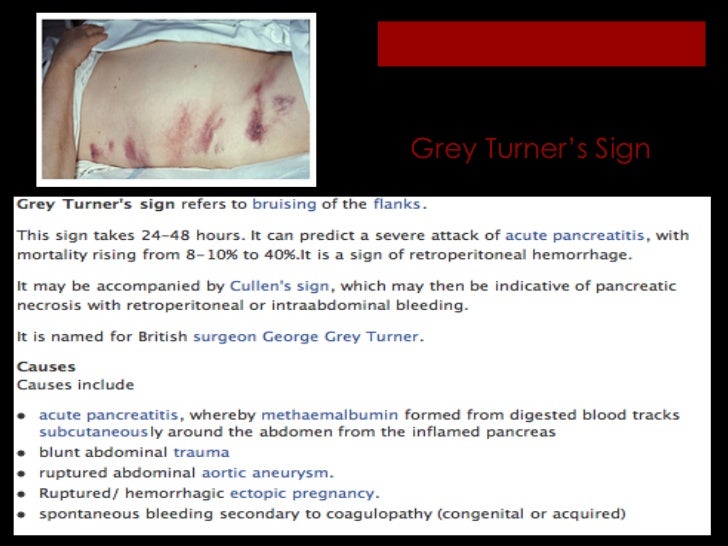 External signs of internal injuries tfinal